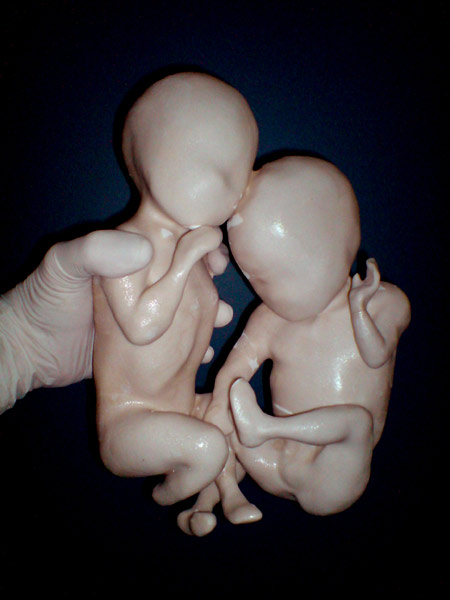 the-fetus-project-by-jorge-lopes-dos-santos-31.jpg