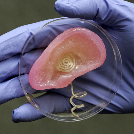 3D-printed bionic ear