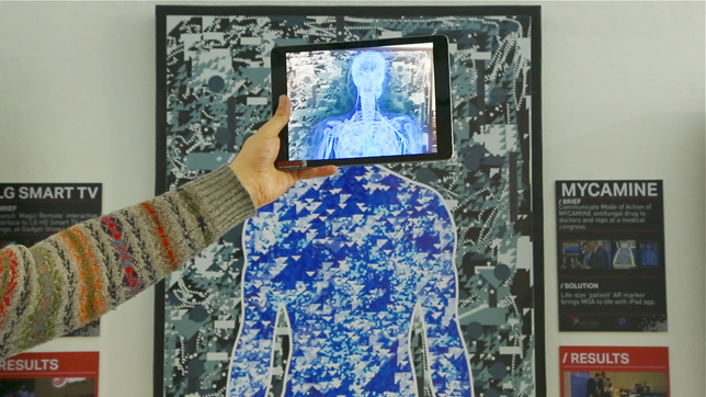 Inition medical augmented reality installation