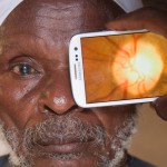 Peek smartphone adapter and app scans eyes to help combat blindness