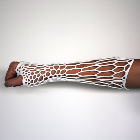 Cortex 3D-printed cast for fractured bones by Jake Evill