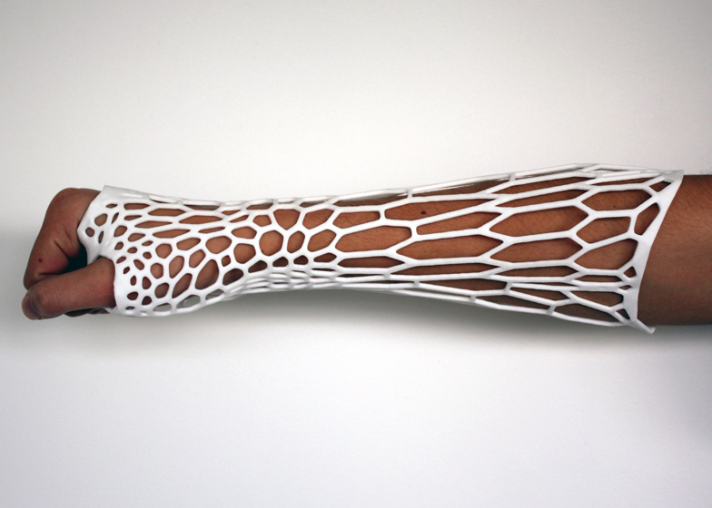 Cortex 3d Printed Cast For Fractured Bones By Jake Evill 