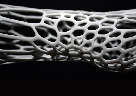 Cortex 3D-printed cast for fractured bones by Jake Evill