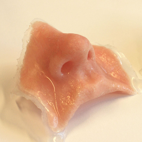 3D-printed noses for accident victims 