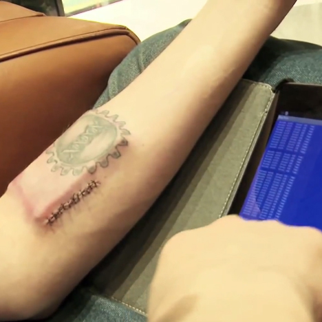 DIY Cyborg implants body tracking device under his skin