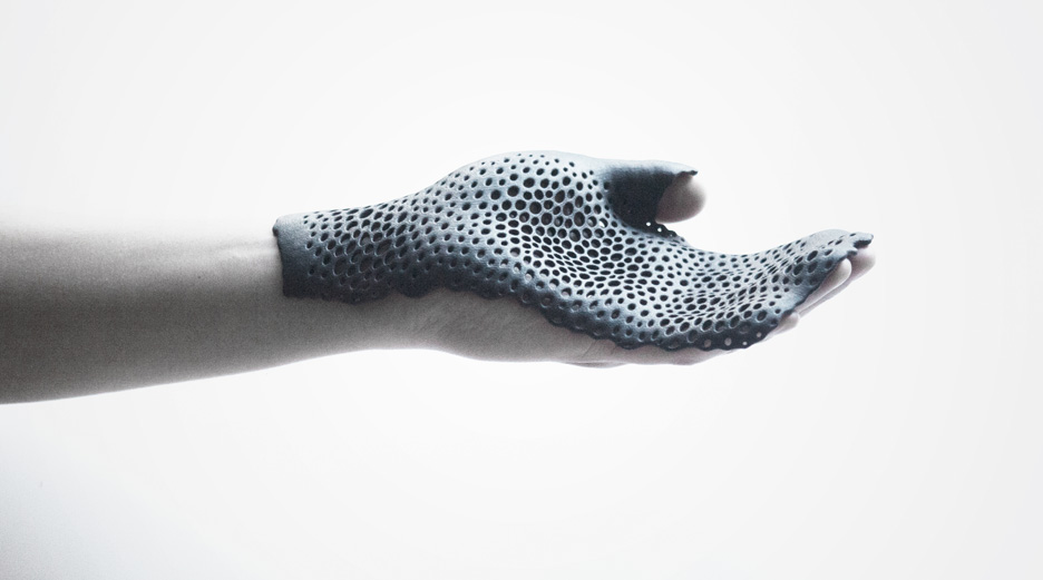 Hand orthosis by MHOX