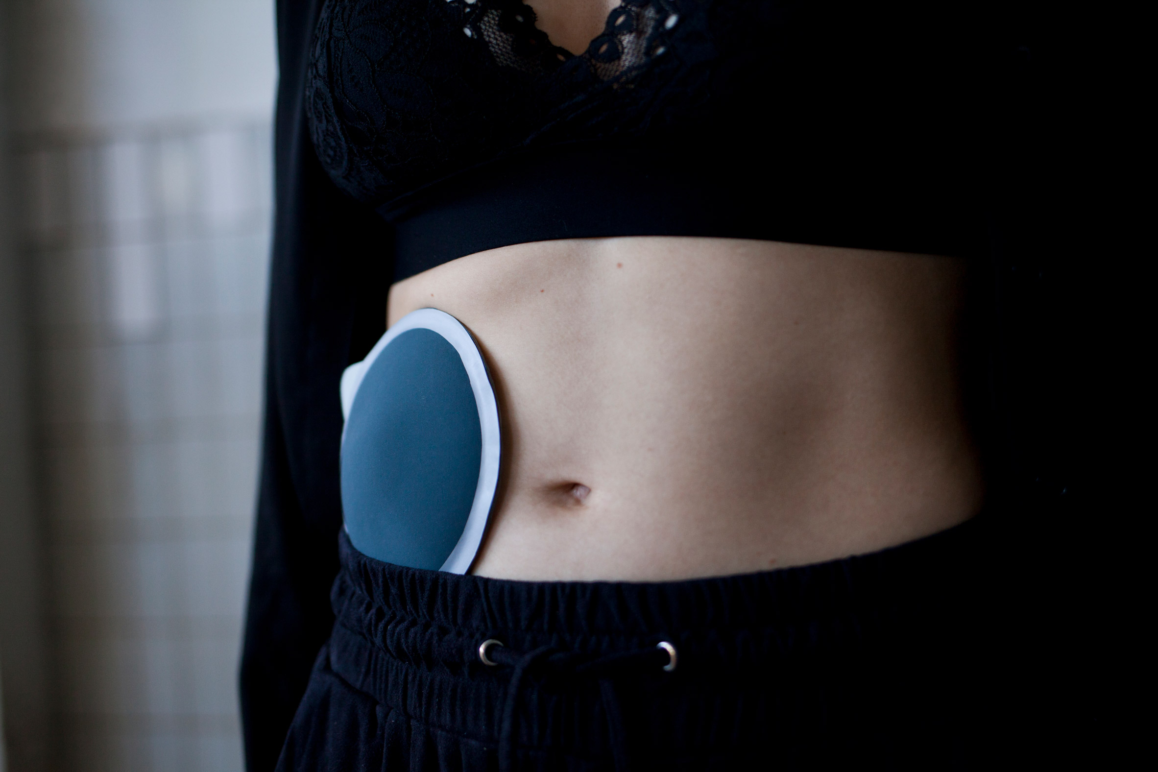 Teddy Schuyers? Guts proposes redesigning the ostomy bag for sex, sport and everyday life