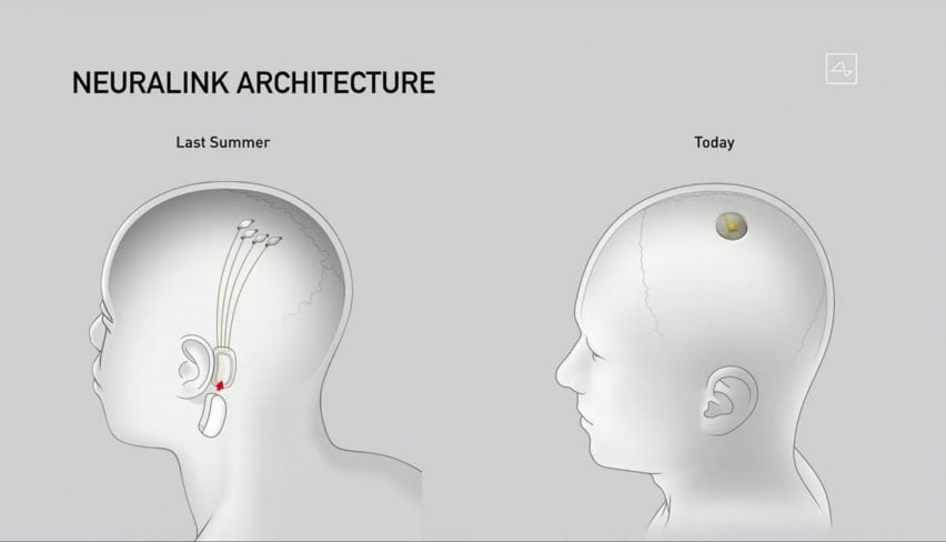 Elon Musk unveils updated Neuralink brain implant design and surgical robot