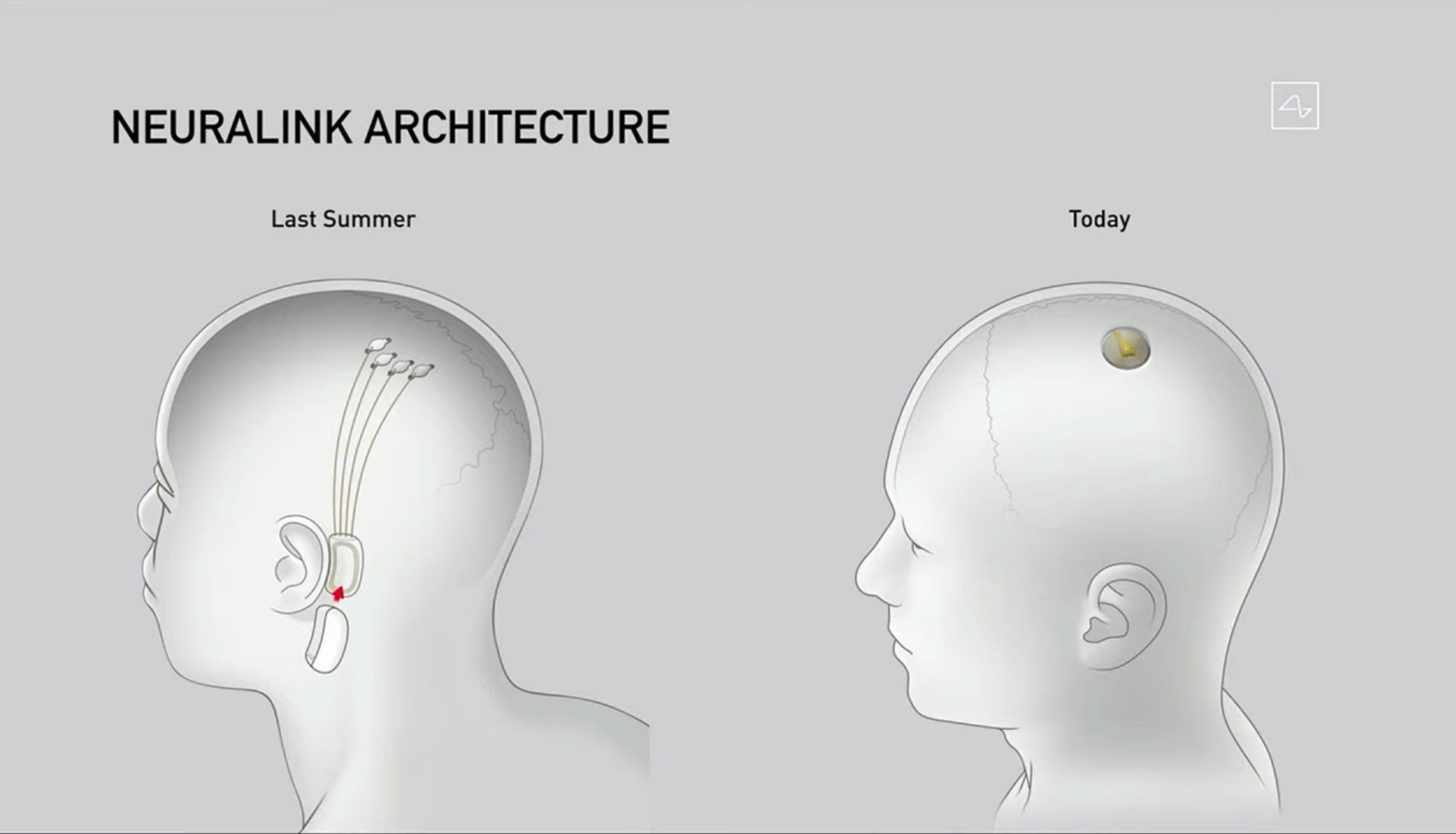 Elon Musk unveils new Neuralink brain implant design and robot that inserts it