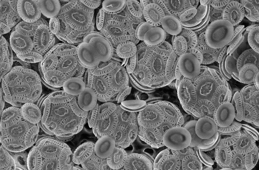 Coccolithophore cells covered with calcium carbonate scales under the microscope