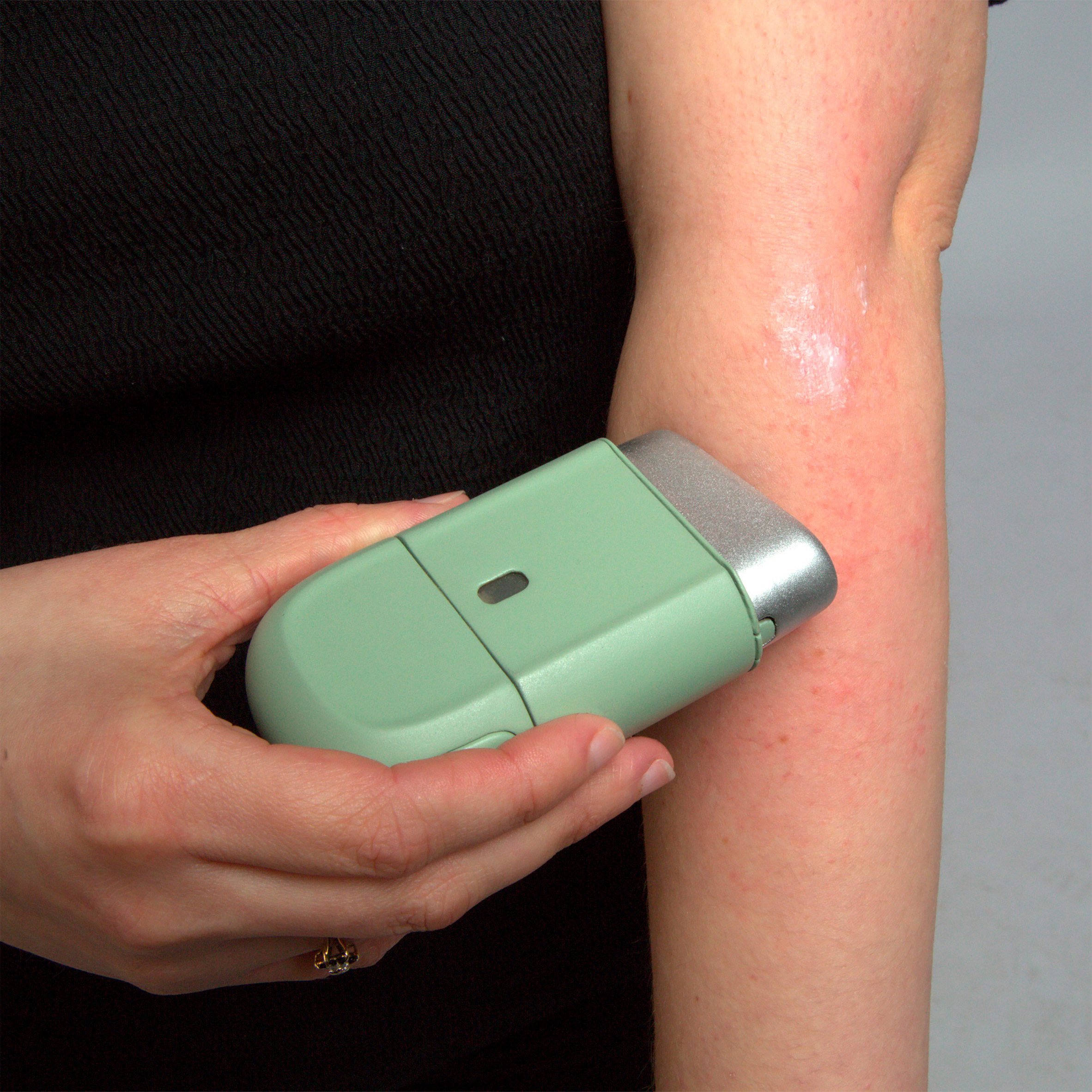 Photograph of device rolling cream onto arm