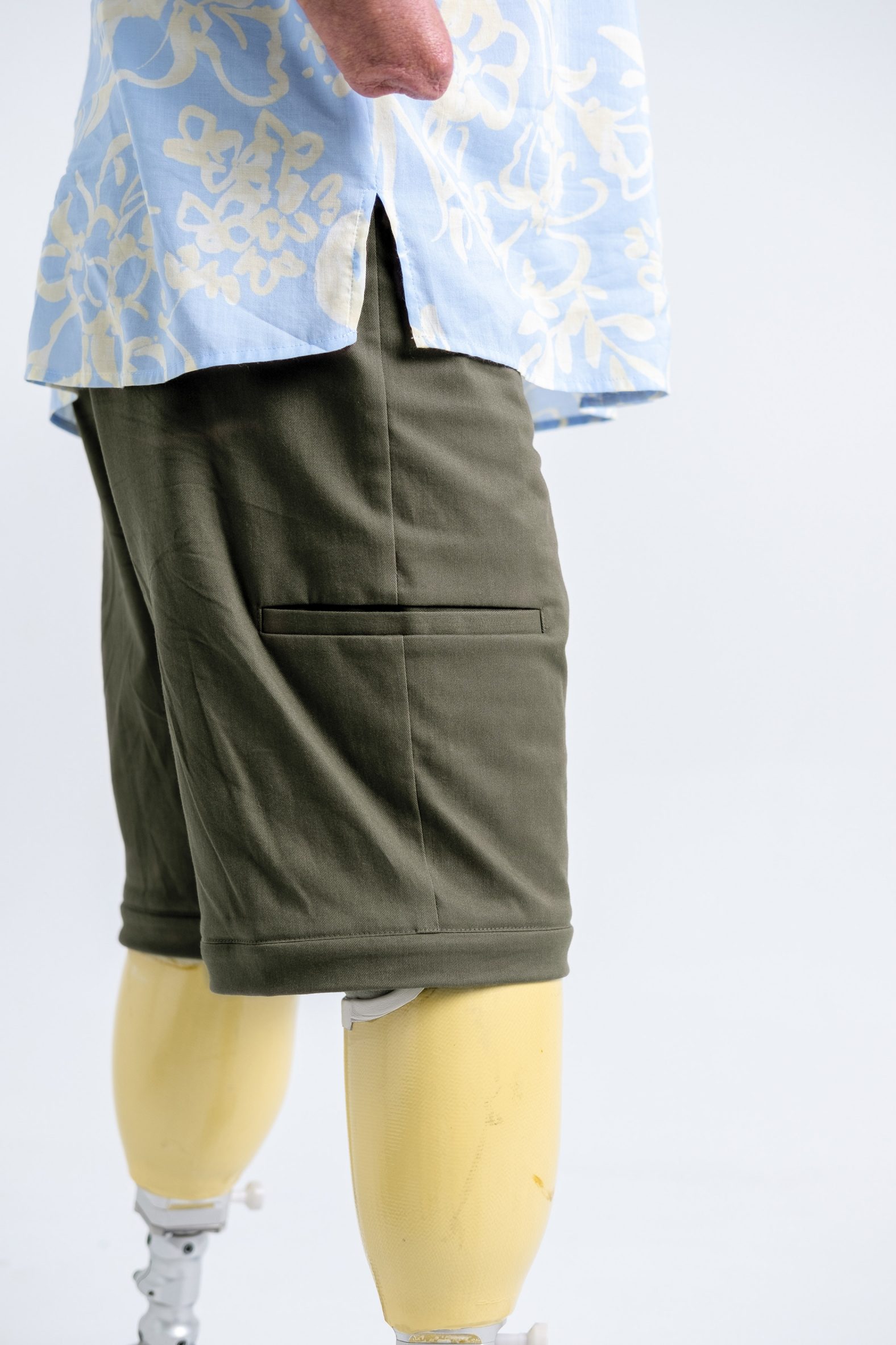 Close-up photo of a person with prosthetic legs wearing Will & Well's Convertible Cargo Pants with the bottoms zipped off to transform them into shorts