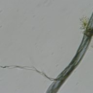 A magnified close up of bioplastic