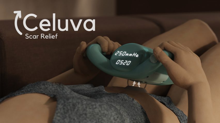 a photograph of a person using a device for scar relief
